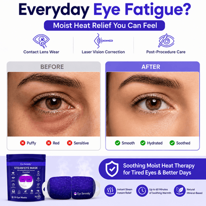Eye Serenity Steam Eye Mask - Self-Heating Warm Eye Compress for Dry Eyes, Puffiness, Sleep & Travel