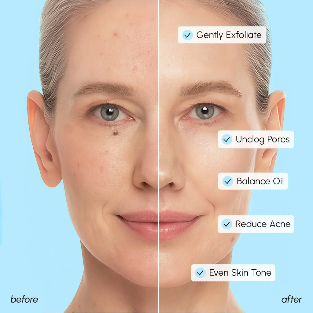 Glycolic & Salicylic Acid Toner Pads